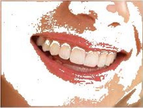 Structuri de zirconiu dinti