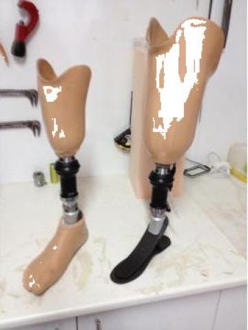 Proteza de gamba de la Ortomedical Plus Srl.